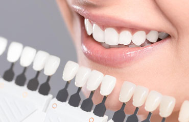 Cosmetic Dentistry
